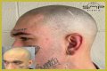 Unveiling The Truth: Steve Austin's Baldness Decoded